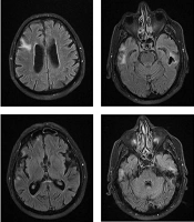 Arch Neurosci
